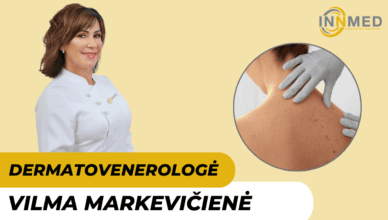 gydytoja-dermatovenerologe-vilma