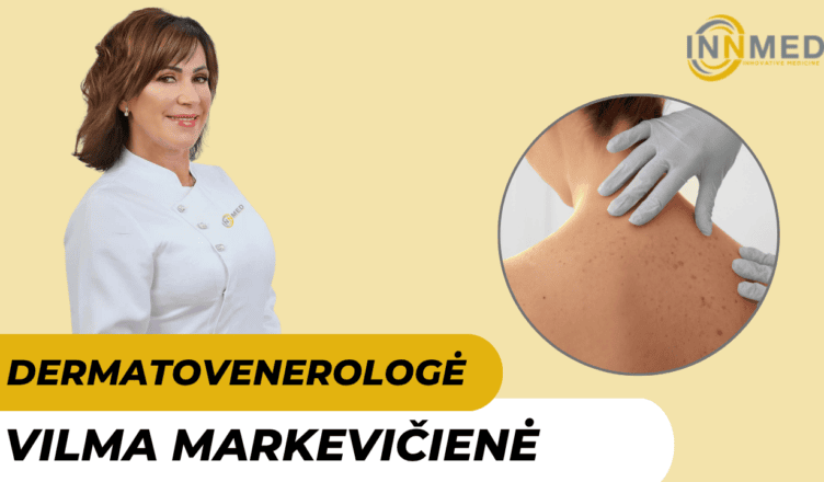 gydytoja-dermatovenerologe-vilma